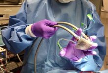 Opinion science progress government heart surgery