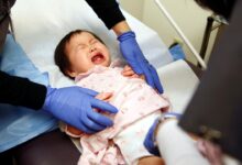 A second child with measles has died in texas as the outbreak continues to spread