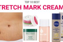 Best pregnancy stretch mark cream